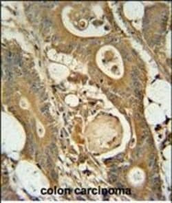 Invitrogen GCNT3 Polyclonal Antibody 400 &mu;L; Unconjugated:Antibodies,