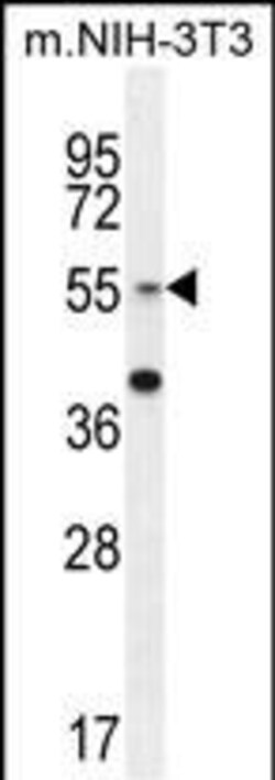 Invitrogen GCNT3 Polyclonal Antibody 400 &mu;L; Unconjugated:Antibodies,