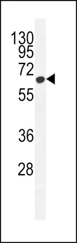Invitrogen ZC3H12A Polyclonal Antibody 400 &mu;L; Unconjugated:Antibodies,