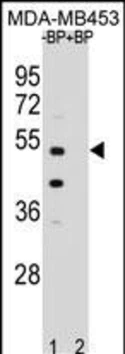 Invitrogen POC1B Polyclonal Antibody 400 &mu;L | Buy Online | Invitrogen&trade; | Fisher Scientific