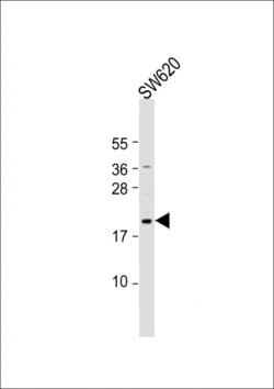 Invitrogen NUDT15 Polyclonal Antibody 400 &mu;L; Unconjugated:Antibodies,