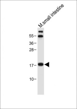 Invitrogen NUDT15 Polyclonal Antibody 400 &mu;L; Unconjugated:Antibodies,