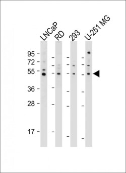 Invitrogen OTUD3 Polyclonal Antibody 400 &mu;L; Unconjugated:Antibodies,