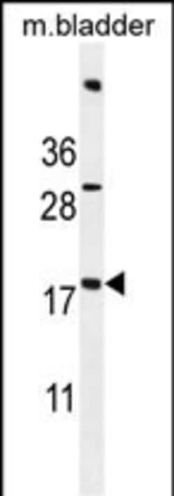 Invitrogen SDHAF3 Polyclonal Antibody 400 &mu;L; Unconjugated:Antibodies,