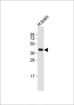 Invitrogen GFRAL Polyclonal Antibody 200 &mu;L; Unconjugated:Antibodies,