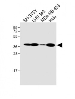 Invitrogen GFRAL Polyclonal Antibody 200 &mu;L; Unconjugated:Antibodies,