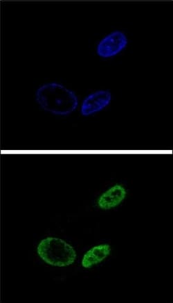 Invitrogen NR0B2 Polyclonal Antibody 400 &mu;L; Unconjugated:Antibodies,