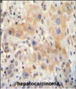 Invitrogen NR0B2 Polyclonal Antibody 400 &mu;L; Unconjugated:Antibodies,