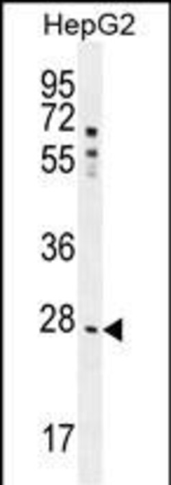Invitrogen NR0B2 Polyclonal Antibody 400 &mu;L; Unconjugated:Antibodies,