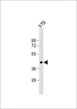 Invitrogen GNAT2 Polyclonal Antibody 400 &mu;L; Unconjugated:Antibodies,