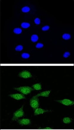 Invitrogen AIRE Polyclonal Antibody 400 &mu;L; Unconjugated:Antibodies,