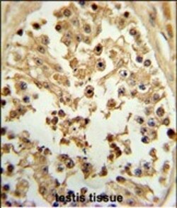 Invitrogen eIF4E Polyclonal Antibody 400 μL; Unconjugated:Antibodies,