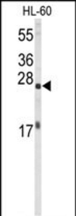 Invitrogen eIF4E Polyclonal Antibody 400 μL; Unconjugated:Antibodies,