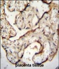 Invitrogen EGFR Polyclonal Antibody 400 &mu;L; Unconjugated:Antibodies,