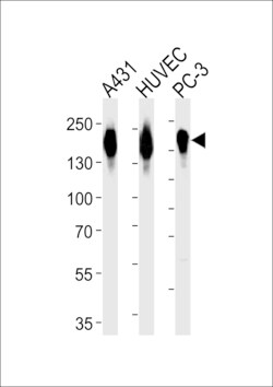 Invitrogen EGFR Polyclonal Antibody 400 &mu;L; Unconjugated:Antibodies,