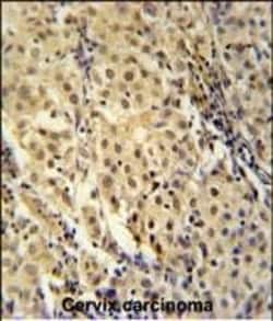 Invitrogen FOXC2 Polyclonal Antibody 400 &mu;L | Buy Online | Invitrogen&trade; | Fisher Scientific