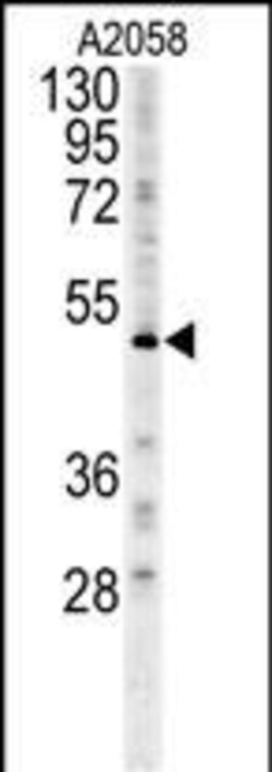 Invitrogen FOXC2 Polyclonal Antibody 400 &mu;L | Buy Online | Invitrogen&trade; | Fisher Scientific