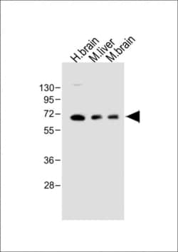 Invitrogen GLS2 Polyclonal Antibody 400 &mu;L; Unconjugated:Antibodies,