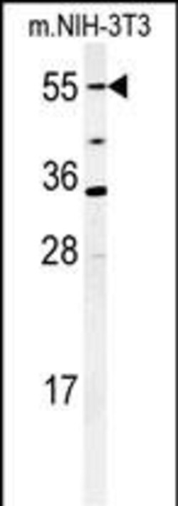 Invitrogen CYP26A1 Polyclonal Antibody 400 &mu;L | Buy Online | Invitrogen&trade; | Fisher Scientific