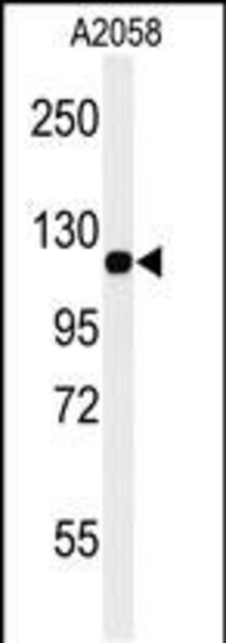 Invitrogen CD146 Polyclonal Antibody 400 μL; Unconjugated:Antibodies,