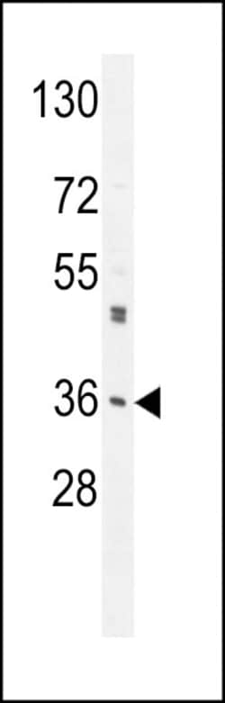 Invitrogen M6PR Polyclonal Antibody 400 &mu;L; Unconjugated:Antibodies,