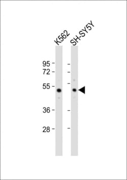 Invitrogen SMPD2 Polyclonal Antibody 400 &mu;L; Unconjugated:Antibodies,