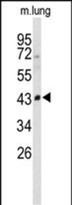 Invitrogen SMPD2 Polyclonal Antibody 400 &mu;L; Unconjugated:Antibodies,
