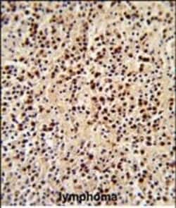 Invitrogen LCK Polyclonal Antibody 400 &mu;L; Unconjugated:Antibodies,