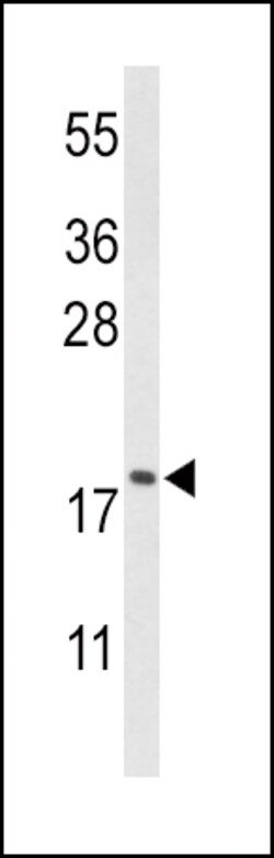 Invitrogen Cofilin Polyclonal Antibody 400 &mu;L; Unconjugated:Antibodies,