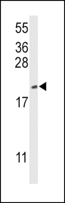 Invitrogen Cofilin Polyclonal Antibody 400 &mu;L; Unconjugated:Antibodies,