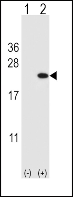 Invitrogen Cofilin Polyclonal Antibody 400 &mu;L; Unconjugated:Antibodies,