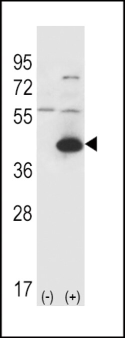 Invitrogen GOT1 Polyclonal Antibody 400 &mu;L; Unconjugated:Antibodies,