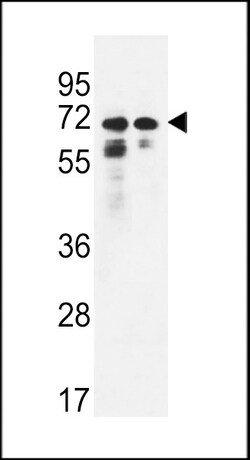 Invitrogen PNPLA8 Polyclonal Antibody 400 &mu;L; Unconjugated:Antibodies,