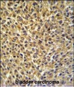 Invitrogen CRIP1 Polyclonal Antibody 400 &mu;L; Unconjugated:Antibodies,