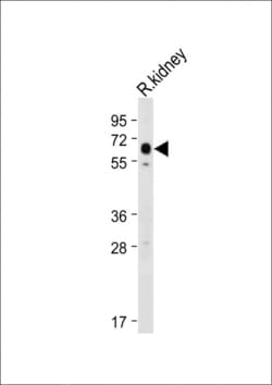 Invitrogen SLC47A2 Polyclonal Antibody 400 &mu;L; Unconjugated:Antibodies,