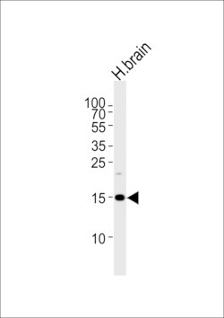 Invitrogen SPRN Polyclonal Antibody 400 &mu;L; Unconjugated:Anticuerpos