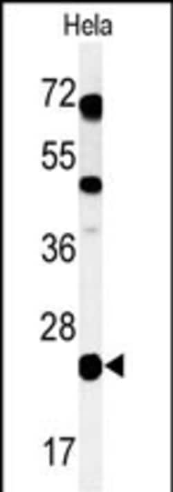 Invitrogen CP054 Polyclonal Antibody 400 &mu;L; Unconjugated:Antibodies,
