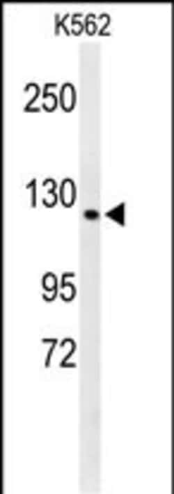 Invitrogen CTC1 Polyclonal Antibody 400 &mu;L | Buy Online | Invitrogen&trade; | Fisher Scientific