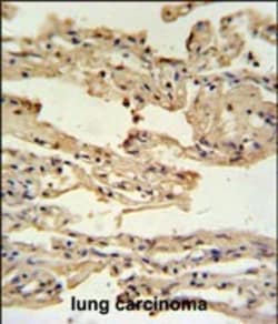 Invitrogen IFITM2 Polyclonal Antibody 400 &mu;L; Unconjugated:Antibodies,