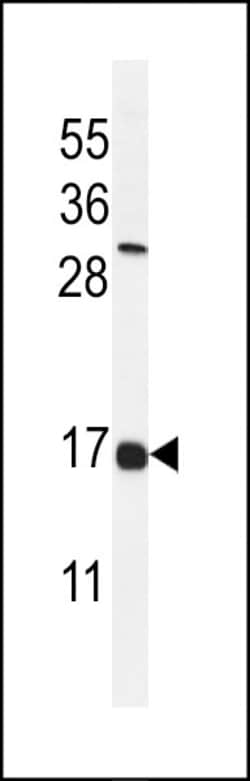 Invitrogen IFITM2 Polyclonal Antibody 400 &mu;L; Unconjugated:Antibodies,