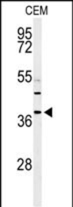 Invitrogen RNaseH2B Polyclonal Antibody 400 &mu;L; Unconjugated:Antibodies,