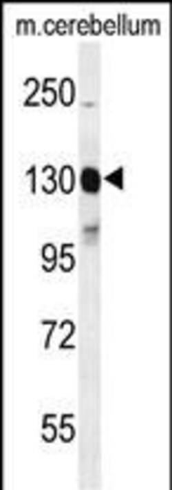 Invitrogen c-Kit Polyclonal Antibody 400 &mu;L | Buy Online | Invitrogen&trade; | Fisher Scientific