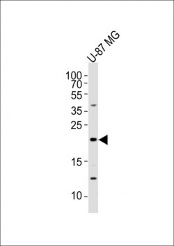 Invitrogen Epiregulin Polyclonal Antibody 400 μL; Unconjugated:Antibodies,