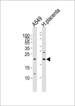 Invitrogen Epiregulin Polyclonal Antibody 400 μL; Unconjugated:Antibodies,