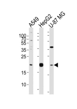 Invitrogen Epiregulin Polyclonal Antibody 400 μL; Unconjugated:Antibodies,