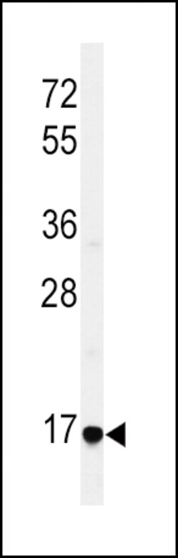 Invitrogen Epiregulin Polyclonal Antibody 400 μL; Unconjugated:Antibodies,