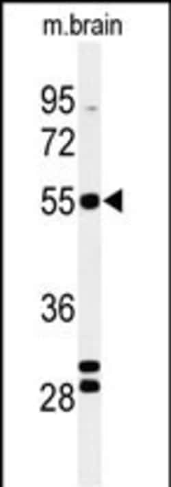 Invitrogen FA2H Polyclonal Antibody 400 &mu;L; Unconjugated:Antibodies,