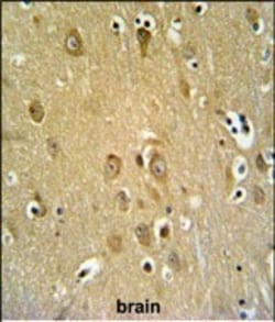 Invitrogen SYTL2 Polyclonal Antibody 400 &mu;L; Unconjugated:Antibodies,