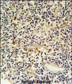 Invitrogen Coronin 6 Polyclonal Antibody 400 &mu;L | Buy Online | Invitrogen&trade; | Fisher Scientific