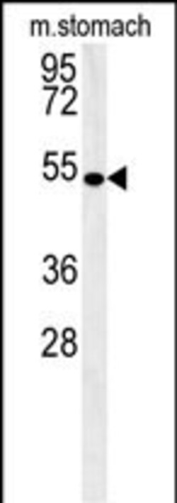 Invitrogen Coronin 6 Polyclonal Antibody 400 &mu;L | Buy Online | Invitrogen&trade; | Fisher Scientific